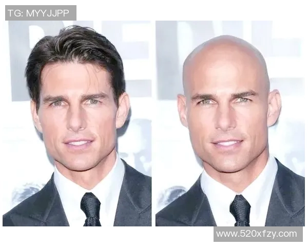 足球场上的秃顶英雄们 揭秘明星球员脱发背后的趣味故事